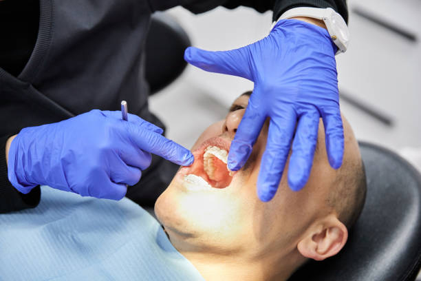Best Urgent Care for Lost Fillings or Crowns in Durant, OK